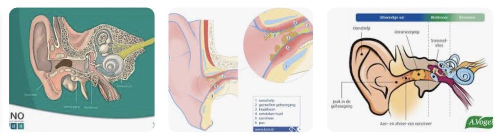 Veelvoorkomende Oorzaken van Jeuk in het Oor