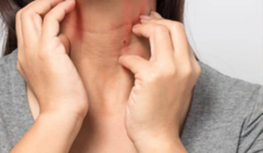 Keltisch Zeezout en Zonneallergie Gezondheid Verzorging Tips en Advies