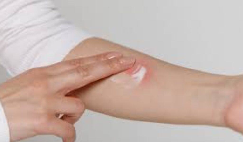 Muggenbeet Voorkomen