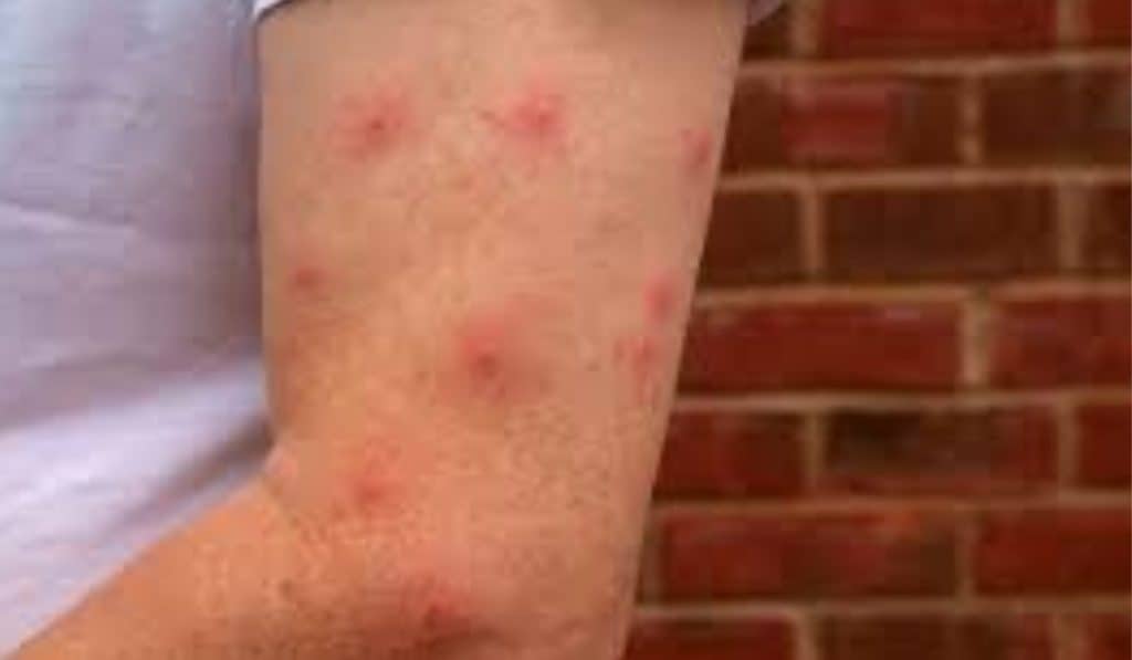 Muggenbeet Voorkomen