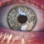 Wat je moet weten over herstel na een ooglaserbehandeling volgens Dr. Javier Martinez